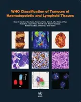 WHO klasifikácia nádorov krvotvorných a lymfatických tkanív - WHO Classification of Tumours of Haematopoietic and Lymphoid Tissues