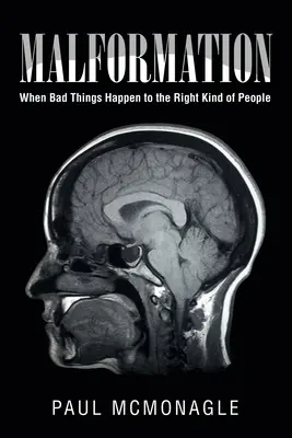 Malformácie: Keď sa zlé veci stávajú správnym ľuďom - Malformation: When Bad Things Happen to the Right Kind of People
