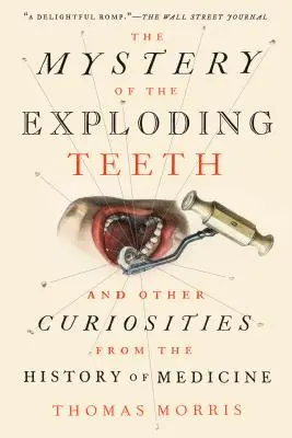 Záhada vybuchujúcich zubov: A iné kuriozity z dejín medicíny - The Mystery of the Exploding Teeth: And Other Curiosities from the History of Medicine