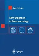 Včasná diagnostika v neuroonkológii - Early Diagnosis in Neuro-Oncology
