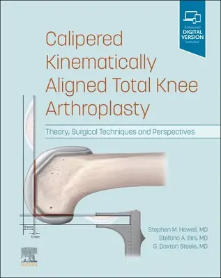Kaliperovaná kinematicky zarovnaná totálna artroplastika kolena: Vydanie publikácie: Teória, chirurgické techniky a perspektívy - Calipered Kinematically Aligned Total Knee Arthroplasty: Theory, Surgical Techniques and Perspectives