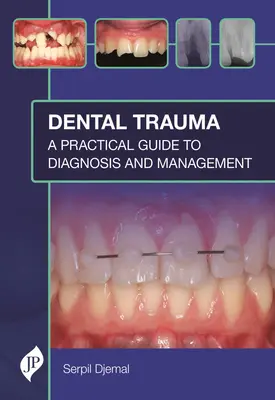 Dentálna trauma: Praktický sprievodca diagnostikou a liečbou - Dental Trauma: A Practical Guide to Diagnosis and Management
