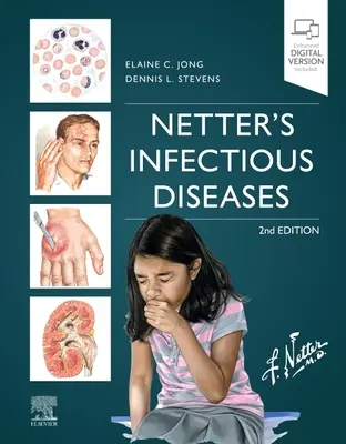 Netterove infekčné choroby - Netter's Infectious Diseases