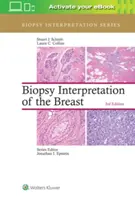 Interpretácia biopsie prsníka - Biopsy Interpretation of the Breast