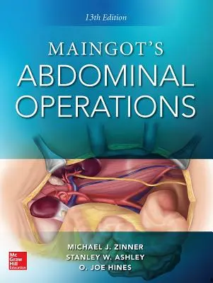 Maingotove brušné operácie. 13. vydanie - Maingot's Abdominal Operations. 13th Edition