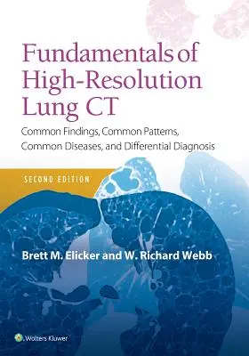 Základy CT pľúc s vysokým rozlíšením: bežné nálezy, bežné vzory, bežné choroby a diferenciálna diagnostika - Fundamentals of High-Resolution Lung CT: Common Findings, Common Patterns, Common Diseases and Differential Diagnosis