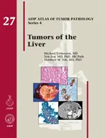 Nádory pečene - Tumors of the Liver
