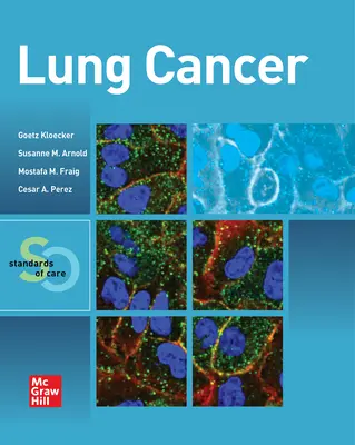 Rakovina pľúc: Štandardy starostlivosti - Lung Cancer: Standards of Care
