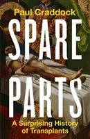 Náhradné diely - Prekvapivé dejiny transplantácií - Spare Parts - A Surprising History of Transplants