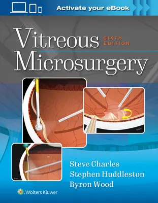 Mikrochirurgia sklovca - Vitreous Microsurgery