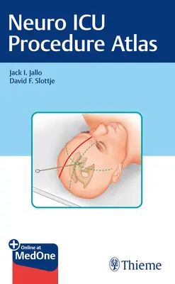 Atlas postupov na neurologickej jednotke intenzívnej starostlivosti - Neuro ICU Procedure Atlas
