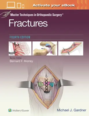 Majstrovské techniky v ortopedickej chirurgii: Zlomeniny - Master Techniques in Orthopaedic Surgery: Fractures