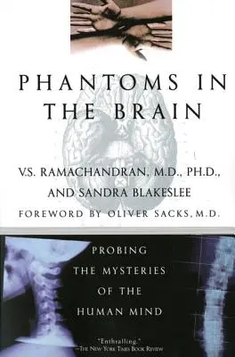 Prízraky v mozgu - Phantoms in the Brain