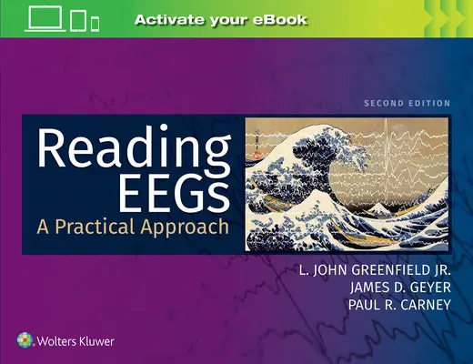 Čítanie EEG: Praktický prístup - Reading Eegs: A Practical Approach