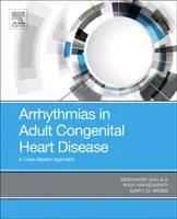 Arytmie pri vrodených srdcových chybách dospelých: Prístup založený na konkrétnych prípadoch - Arrhythmias in Adult Congenital Heart Disease: A Case-Based Approach