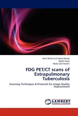 FDG PET/CT vyšetrenia extrapulmonálnej tuberkulózy - FDG PET/CT scans of Extrapulmonary Tuberculosis