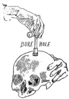 Diera po vrte - Bore Hole
