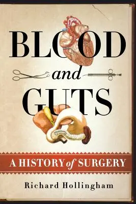 Krv a vnútornosti: Dejiny chirurgie - Blood and Guts: A History of Surgery