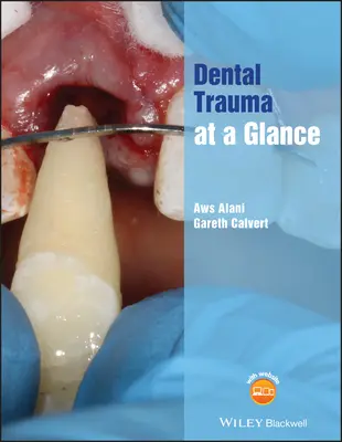 Zubný úraz v skratke - Dental Trauma at a Glance