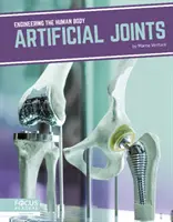 Umelé kĺby - Artificial Joints