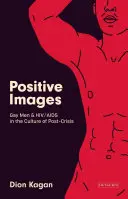 Pozitívne obrazy: Homosexuálni muži a Hiv/AIDS v kultúre „po kríze - Positive Images: Gay Men and Hiv/AIDS in the Culture of 'Post Crisis'