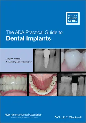Praktická príručka ADA o zubných implantátoch - The ADA Practical Guide to Dental Implants
