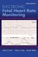 Elektronické monitorovanie srdcovej frekvencie plodu: Päťstupňový systém: Päťúrovňový systém - Electronic Fetal Heart Rate Monitoring: The 5-Tier System: The 5-Tier System
