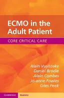 ECMO u dospelého pacienta - ECMO in the Adult Patient