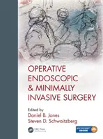 Operačná endoskopická a minimálne invazívna chirurgia - Operative Endoscopic and Minimally Invasive Surgery