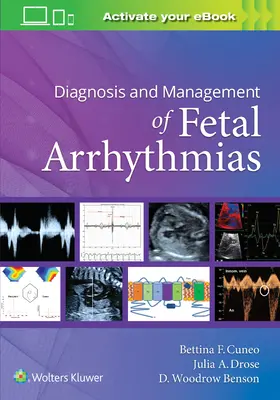 Diagnostika a liečba arytmií plodu - Diagnosis and Management of Fetal Arrhythmias