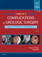 Komplikácie urologickej chirurgie: Prevencia a zvládanie - Complications of Urologic Surgery: Prevention and Management