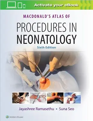 Macdonaldov atlas postupov v neonatológii - Macdonald's Atlas of Procedures in Neonatology