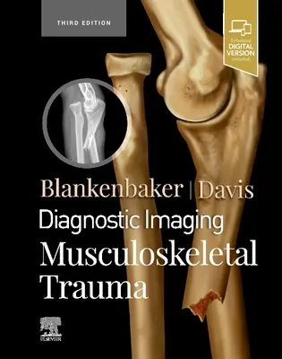 Diagnostické zobrazovanie: Muskuloskeletálne traumy - Diagnostic Imaging: Musculoskeletal Trauma