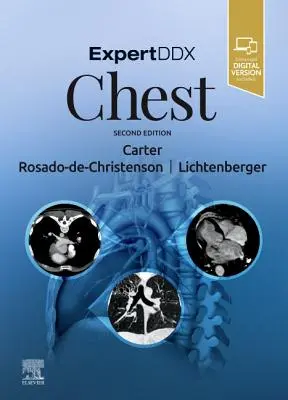 ExpertDDx: Hrudník - ExpertDDx: Chest