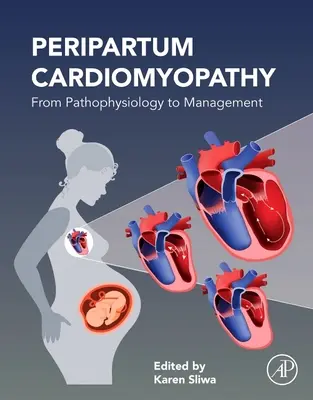 Peripartálna kardiomyopatia: Od patofyziológie k manažmentu - Peripartum Cardiomyopathy: From Pathophysiology to Management