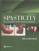 Spasticita: Diagnostika a manažment - Spasticity: Diagnosis and Management