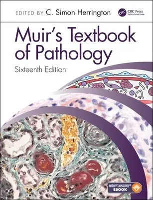 Muirova učebnica patológie - Muir's Textbook of Pathology