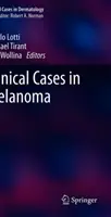Klinické prípady melanómu - Clinical Cases in Melanoma