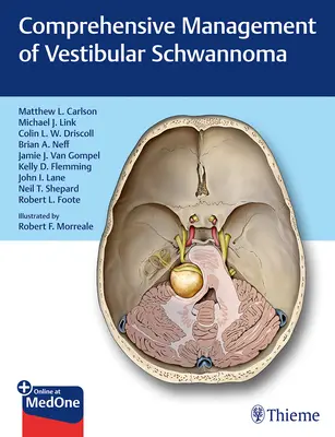 Komplexná liečba vestibulárneho schwannómu - Comprehensive Management of Vestibular Schwannoma