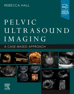 Ultrazvukové zobrazovanie panvy: A Cased-Based Approach - Pelvic Ultrasound Imaging: A Cased-Based Approach