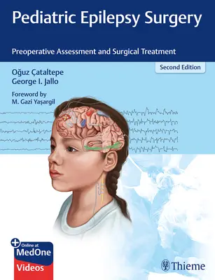 Pediatrická chirurgia epilepsie: Predoperačné hodnotenie a chirurgická liečba - Pediatric Epilepsy Surgery: Preoperative Assessment and Surgical Treatment