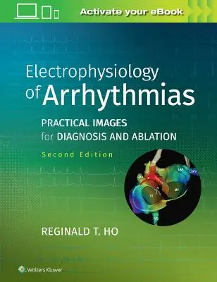 Elektrofyziológia arytmií: Praktické obrázky na diagnostiku a abláciu - Electrophysiology of Arrhythmias: Practical Images for Diagnosis and Ablation
