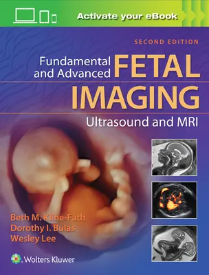 Základné a pokročilé zobrazovanie plodu ultrazvukom a magnetickou rezonanciou - Fundamental and Advanced Fetal Imaging Ultrasound and MRI