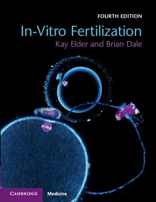 Oplodnenie in vitro - In-Vitro Fertilization
