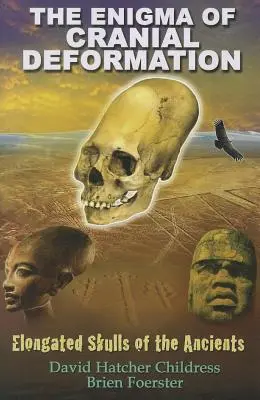 Záhada deformácie lebky: Podlhovasté lebky starých ľudí - The Enigma of Cranial Deformation: Elongated Skulls of the Ancients