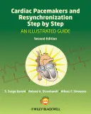 Kardiostimulátory a resynchronizácia krok za krokom: Ilustrovaný sprievodca - Cardiac Pacemakers and Resynchronization Step by Step: An Illustrated Guide