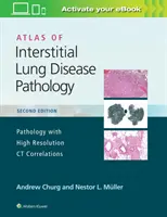 Atlas patológie intersticiálnych pľúcnych chorôb - Atlas of Interstitial Lung Disease Pathology