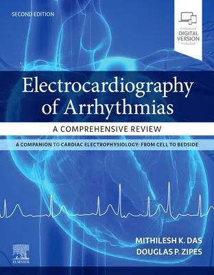 Elektrokardiografia arytmií: Komplexný prehľad - Electrocardiography of Arrhythmias: A Comprehensive Review