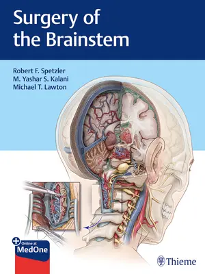 Chirurgia mozgového kmeňa - Surgery of the Brainstem