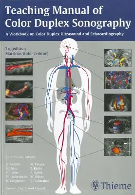 Výučbová príručka farebnej duplexnej sonografie - Teaching Manual of Color Duplex Sonography
